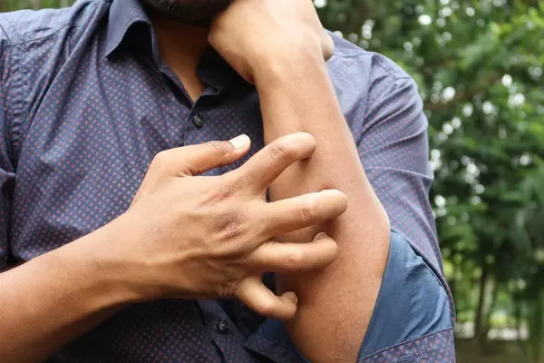 NAD Deficiency Symptoms: 6 Common Signs of Low NAD Levels 6 an image of a man holding his arm