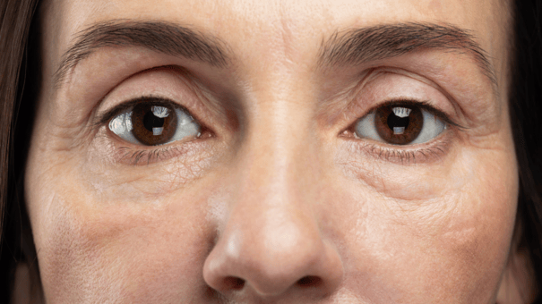 The Regenerative Benefits of NAD+ for Aging Skin 4 An image of a matured woman depicting aging