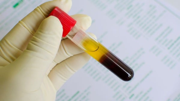 Cellular Degeneration: What It Is and Why It Matters 8 An image of biomarker testing