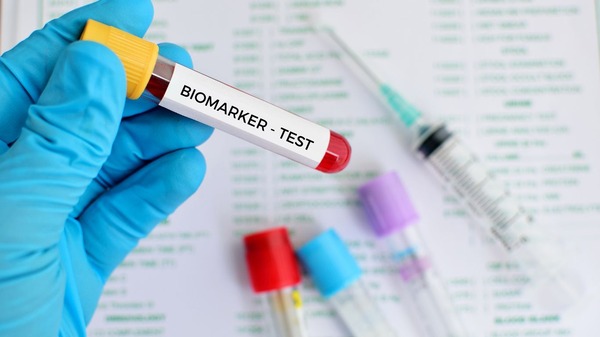 An image of biomarker test