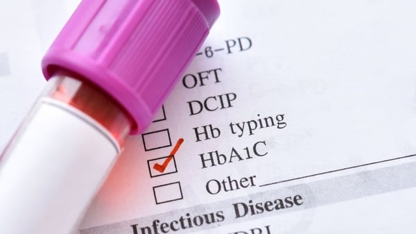 An image of Testing and Monitoring Oxidative Stress