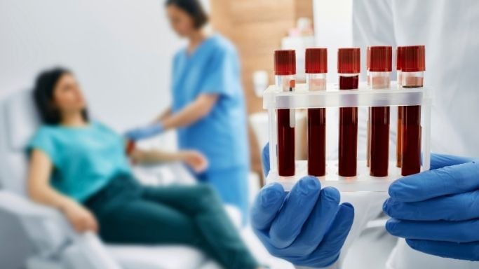 Inflammatory Biomarkers: What Do They Reveal? 8 An image of measuring baseline inflammatory markers