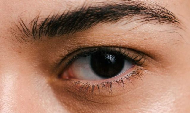 What Does Body Age Mean and Can You Actually Lower It? 3 dark circles under eyes 1 012cd4fc