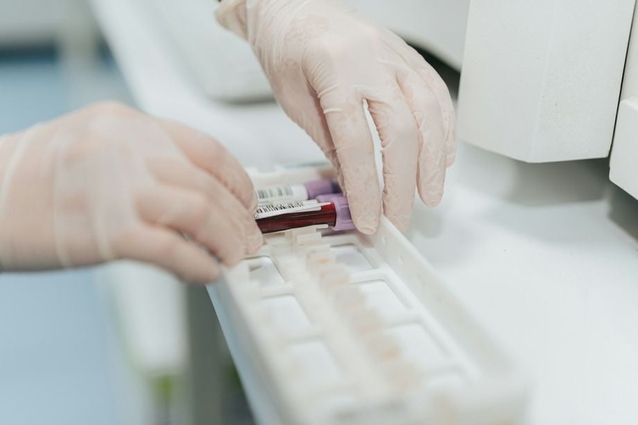 Total Antioxidant Capacity (TAC) Test: What Does it Measure? 1 Total Antioxidant Capacity (TAC) Test: What Does it Measure?