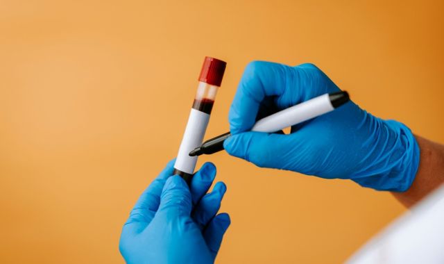 5 Promising Benefits of NAD Supplements (and Side Effects) 9 uric acid test 6d5bad69