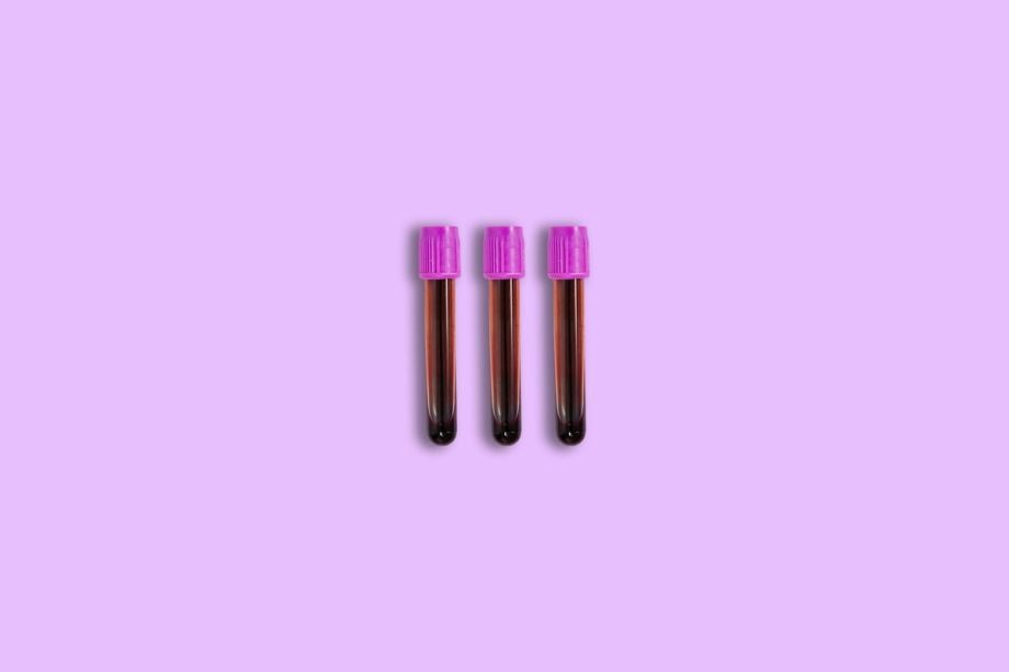 What is an Albumin Blood Test? Understanding Normal Ranges and Results 1 What is an Albumin Blood Test? Understanding Normal Ranges and Results