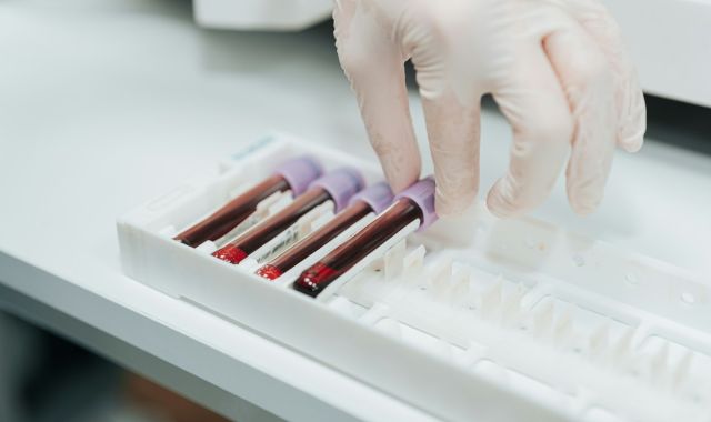 5 Promising Benefits of NAD Supplements (and Side Effects) 8 gsp tests a52aee82