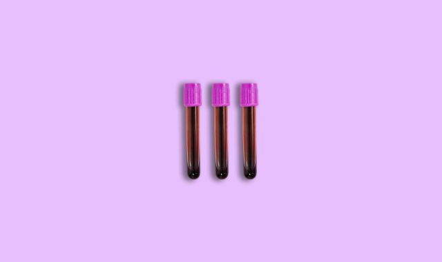 What is 8-OHdG? Understanding DNA Oxidative Stress 3 albumin blood test de8cbbea