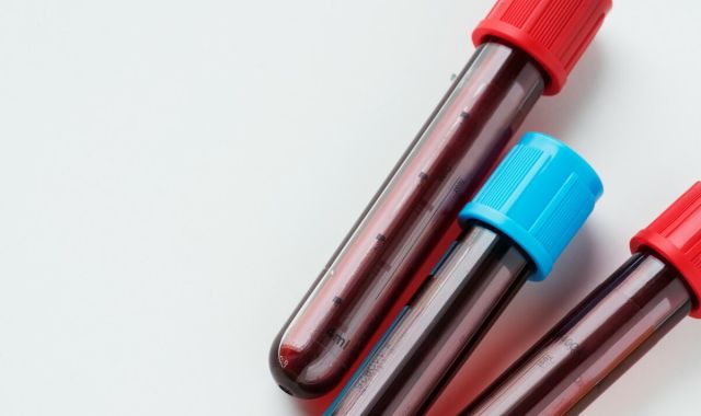 cytokine blood test ec59c683