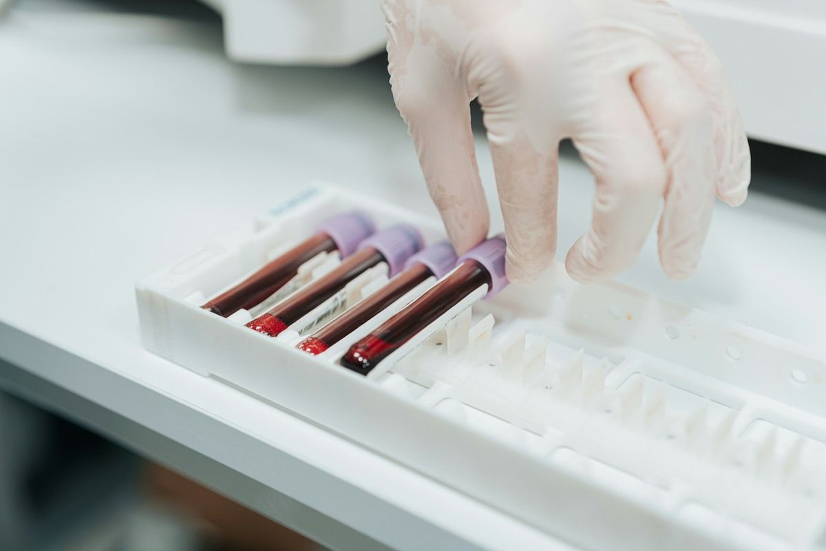 A nurse inserts a blood test vial into a tray in the lab.
