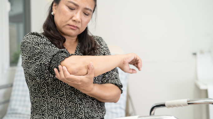 A woman holding her elbow with a pained expression, indicating muscle discomfort.
