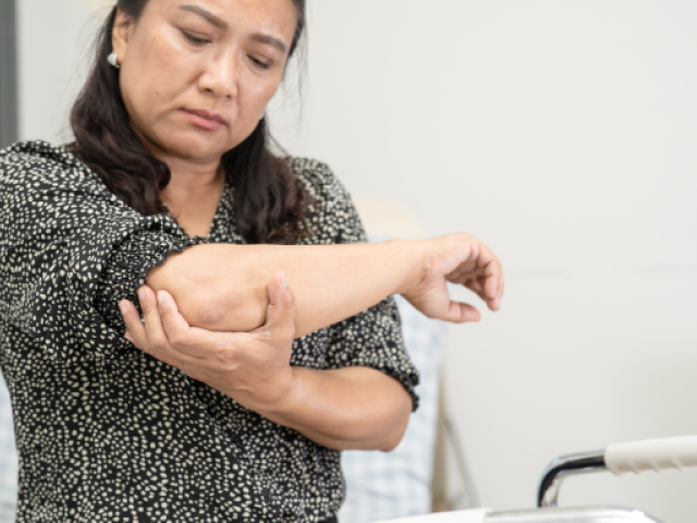 Why NAD+ Matters for Bodybuilding and Muscle Growth 5 A woman holding her elbow with a pained expression, indicating muscle discomfort.