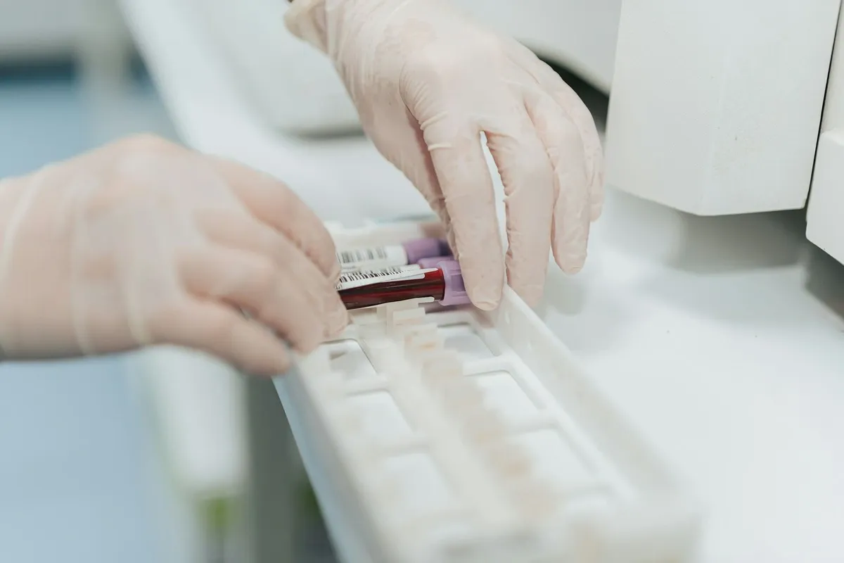 Medical professional in protective gloves handles labeled blood test vials in sterile laboratory.
