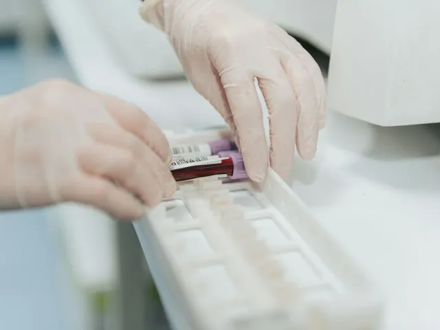 Medical professional in protective gloves handles labeled blood test vials in sterile laboratory.