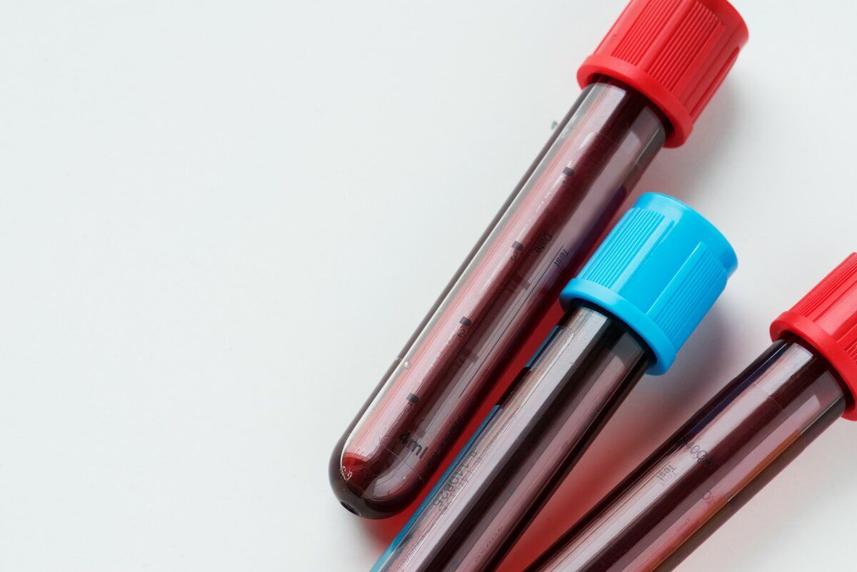 Closeup of three blood test vials with red and blue caps.