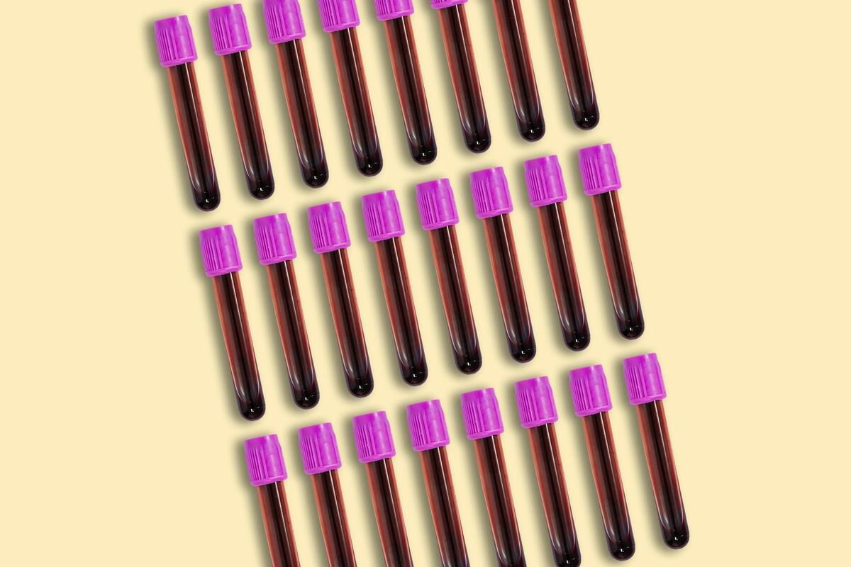 Multiple blood test vials against a yellow background.