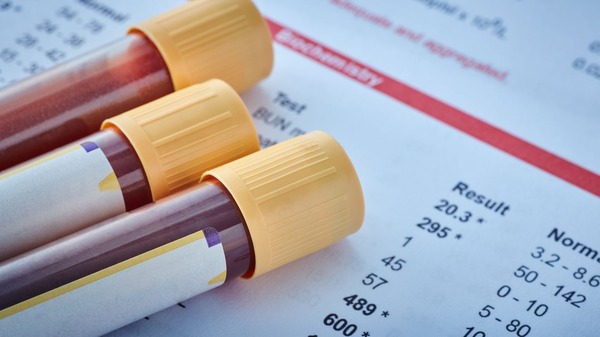 An image of blood test results and blood vials
