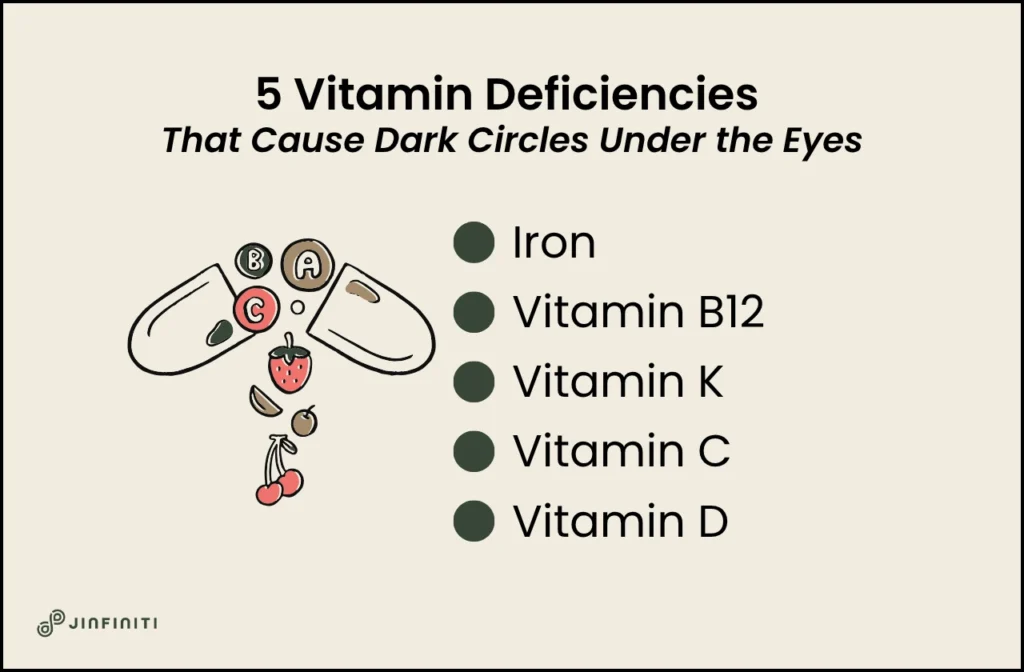 Infographic showing vitamin deficiencies that cause dark circles under the eyes