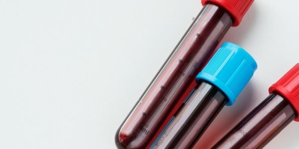 Closeup of three blood test vials with red and blue caps.