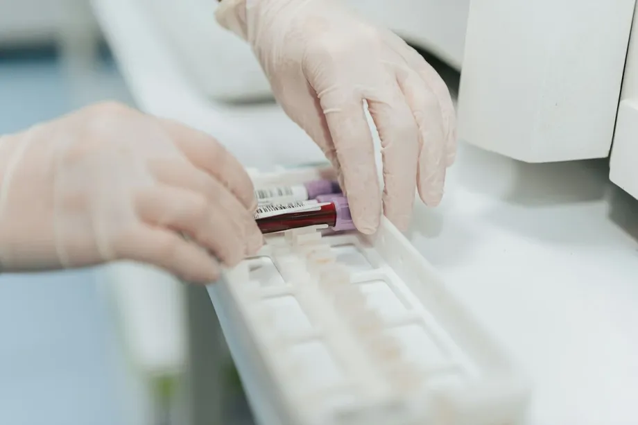 Cystatin C Test: Normal Range, High Levels and Why It Matters