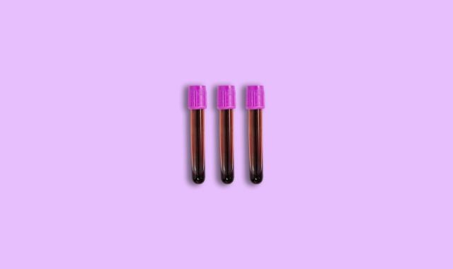 albumin blood test de8cbbea